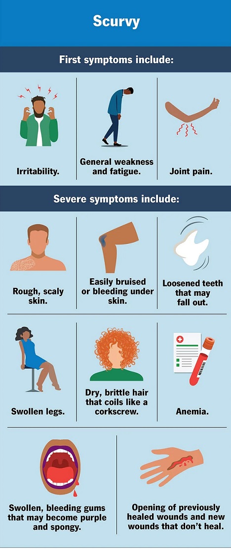 scurvy symptoms poster