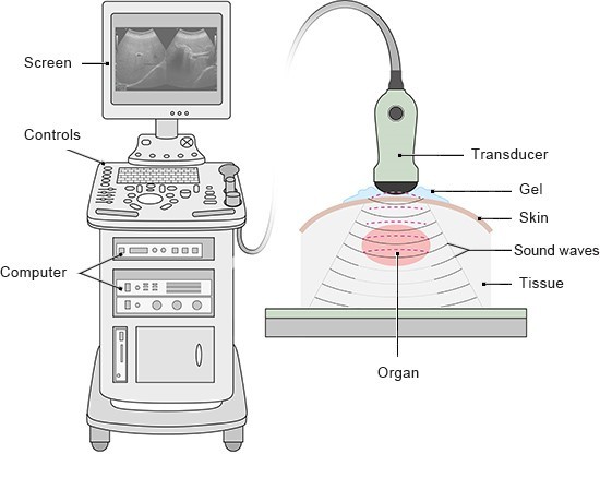 poster: how an ultrasound works